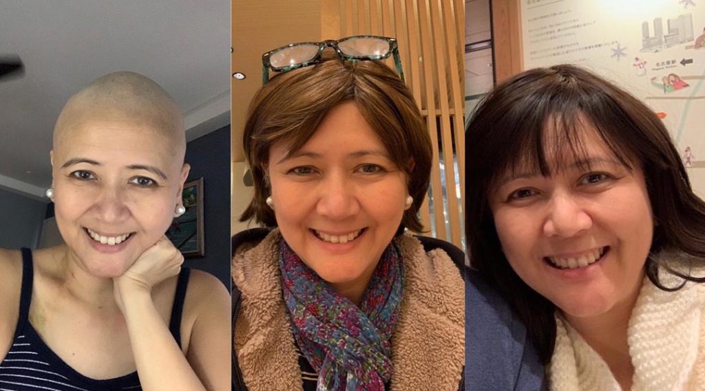 breast cancer aina lacson wigs