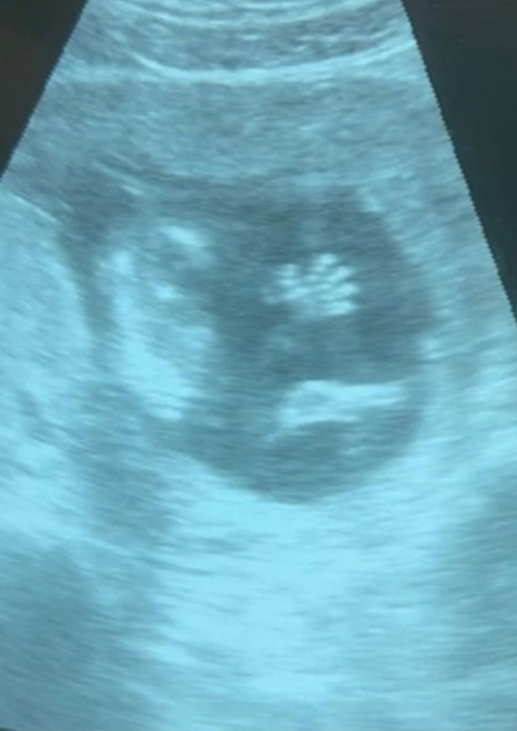 Jessy Mendiola and Luis Manzano