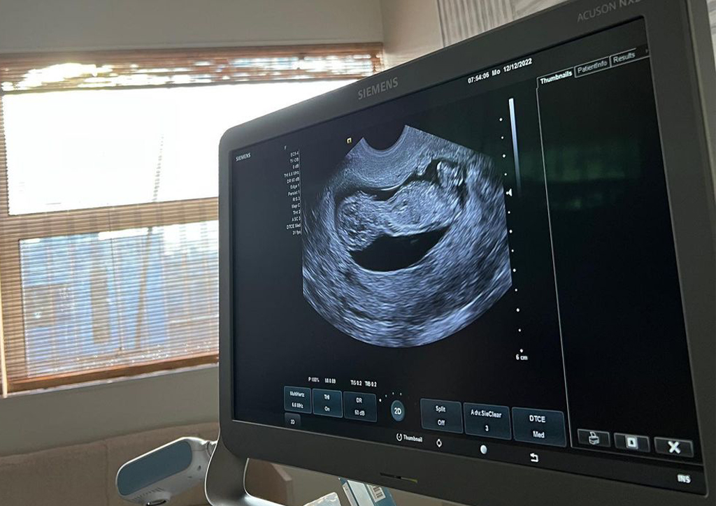 Naomi Osaka is pregnant!