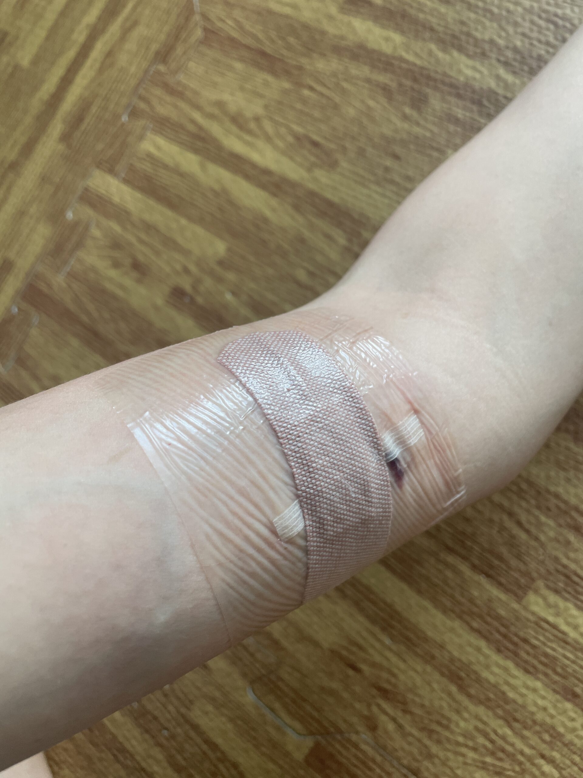 contraceptive implant