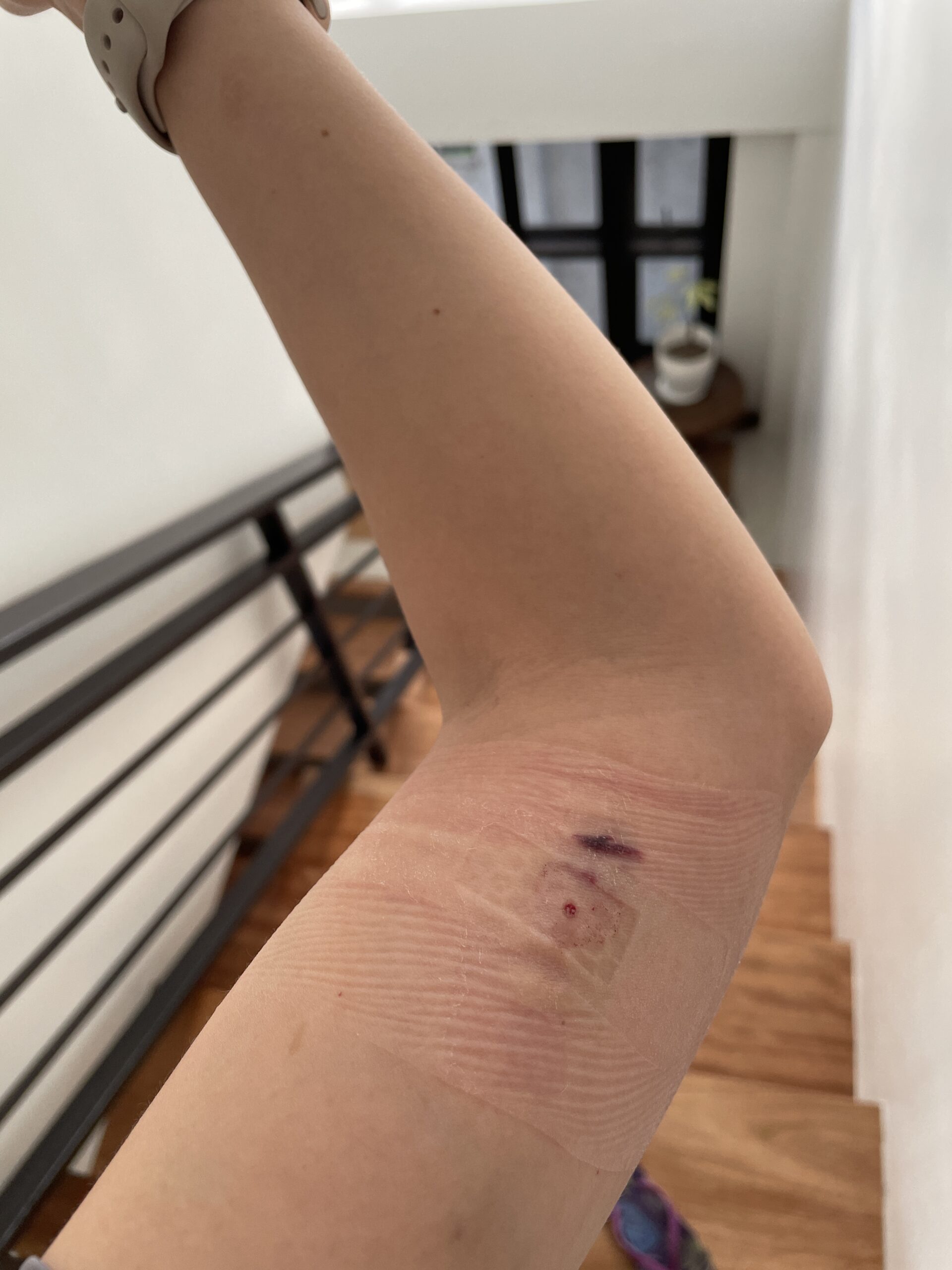 Contraceptive implant effect