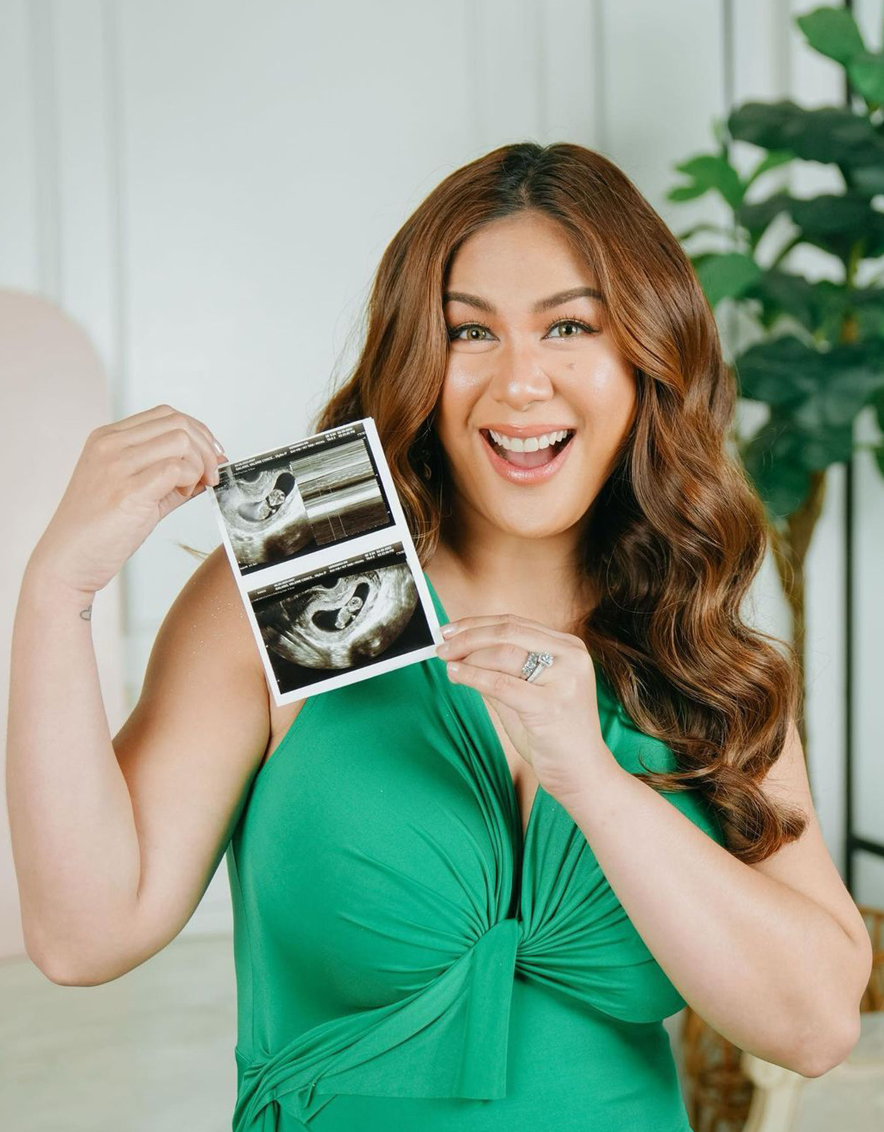 Valerie Concepcion with her sonogram