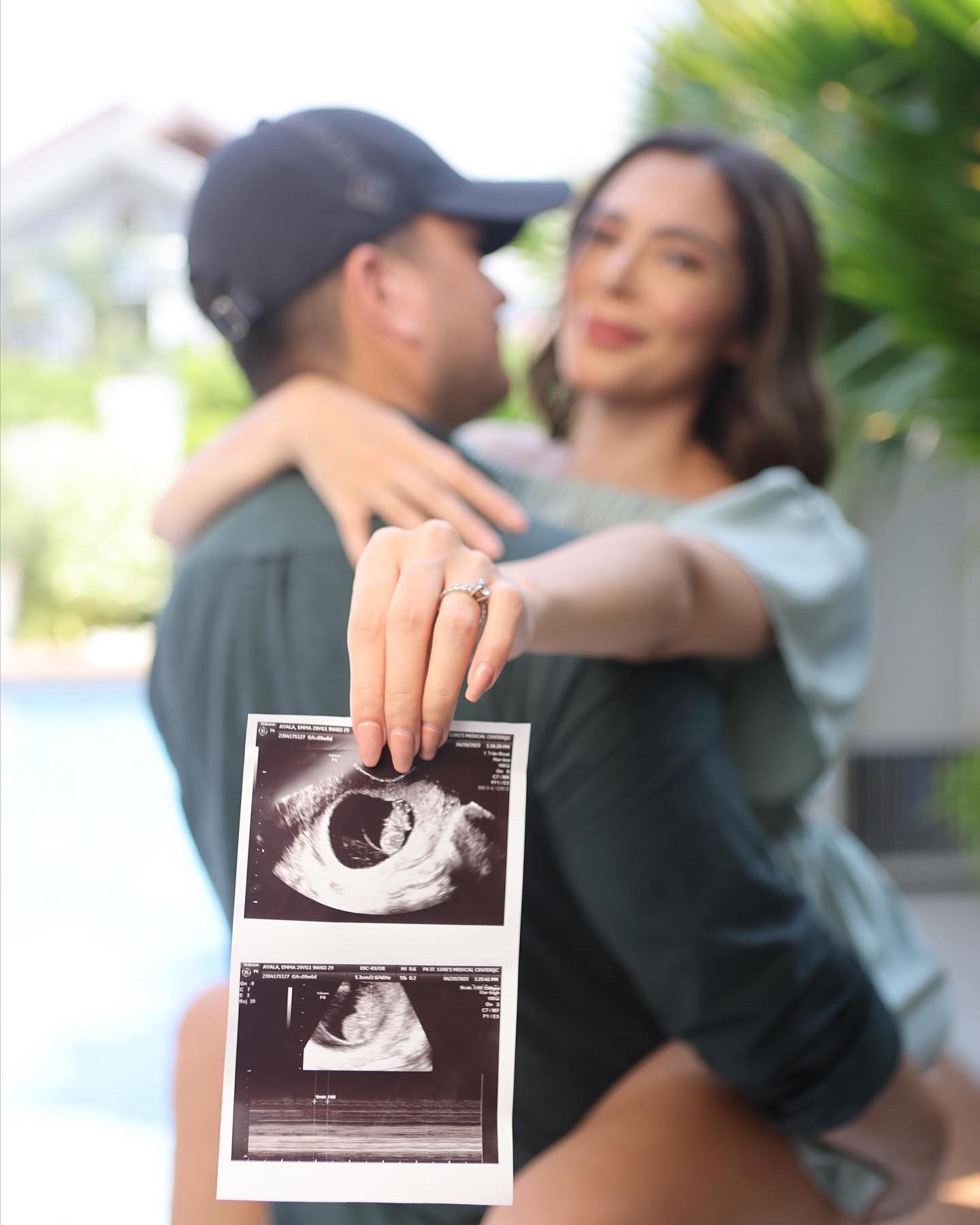 Lucho Ayala and Emma Rueda baby Sonogram