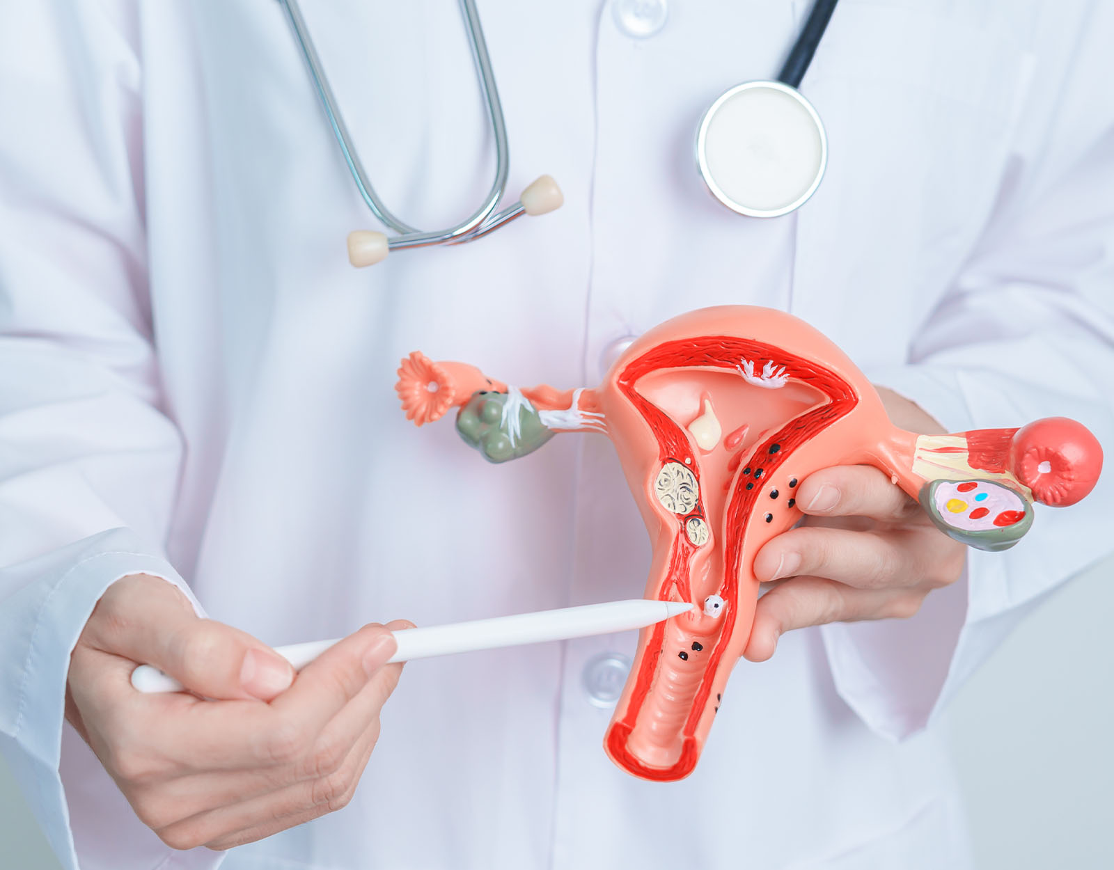 A New Study on Endometriosis Shines Hope for Infertility