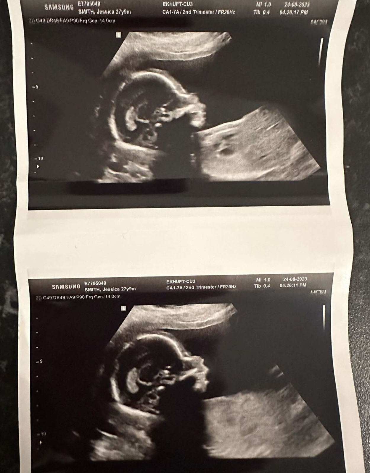 Teletubbies "Sun Baby" Jess Smith Pregnant With Her First Baby!