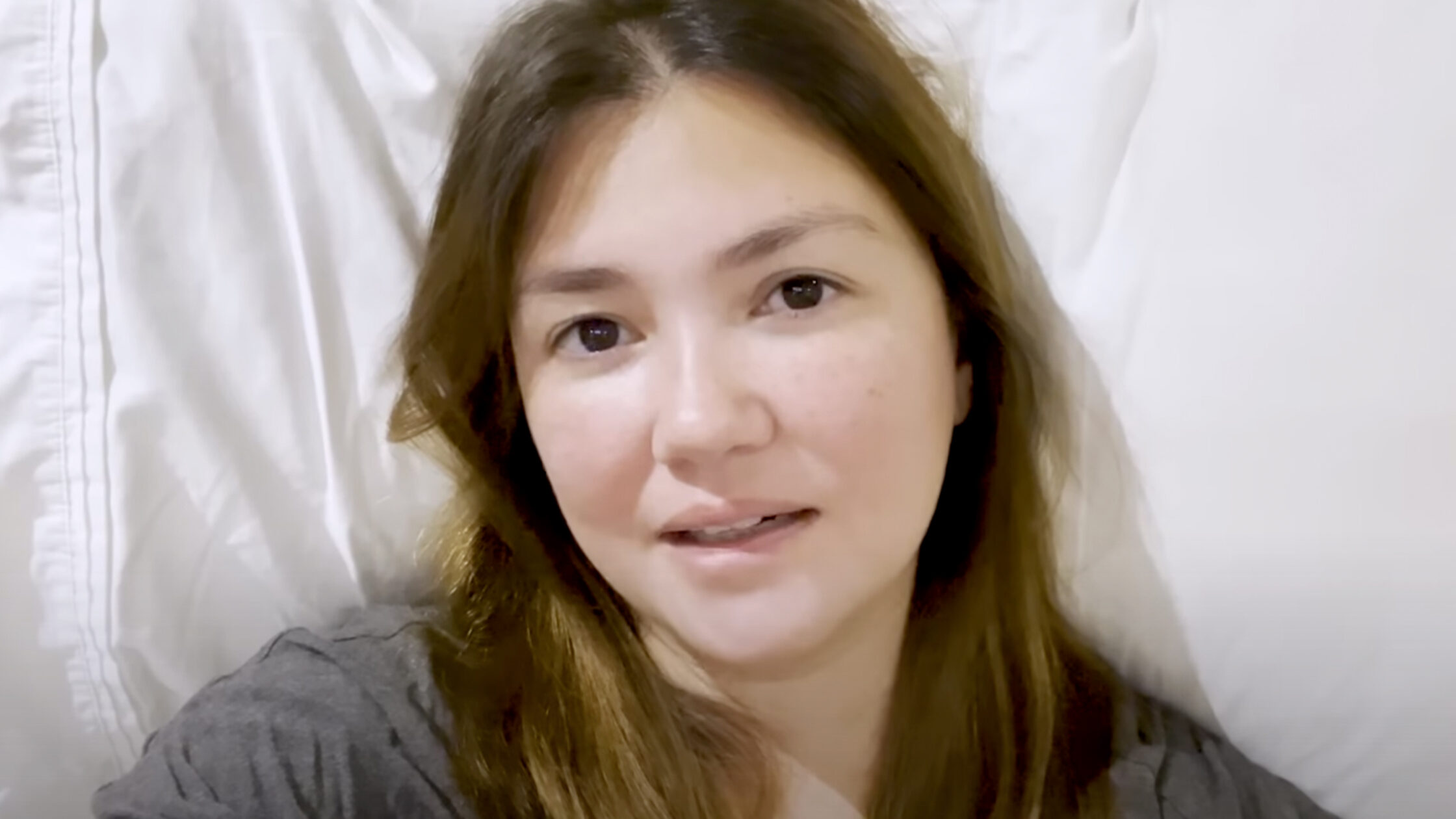 Angelica Panganiban's Bone Disease: 