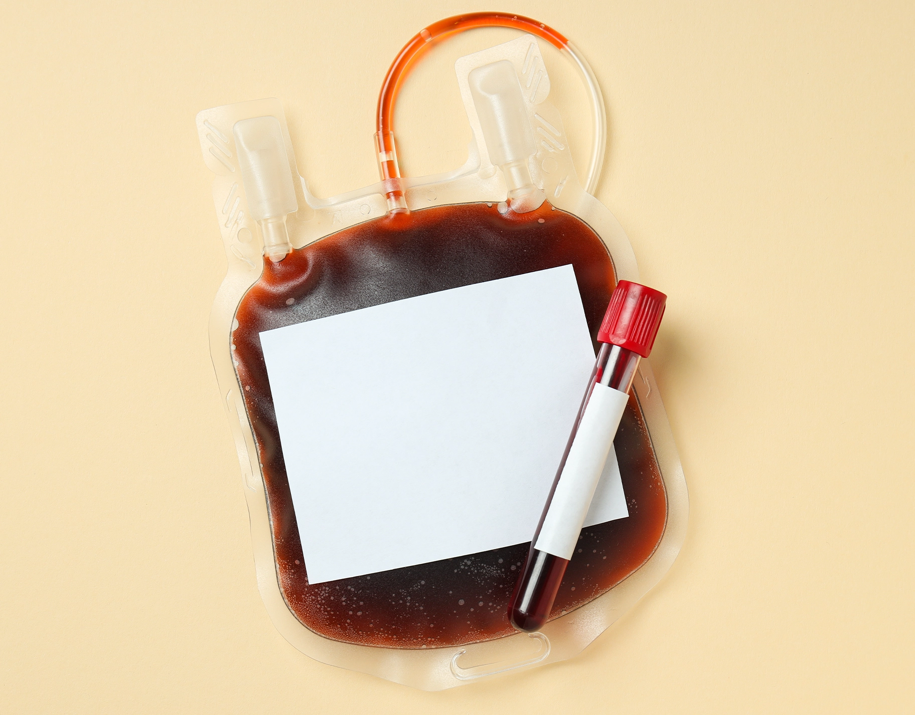 Here's what parents need to know about cord blood banking
