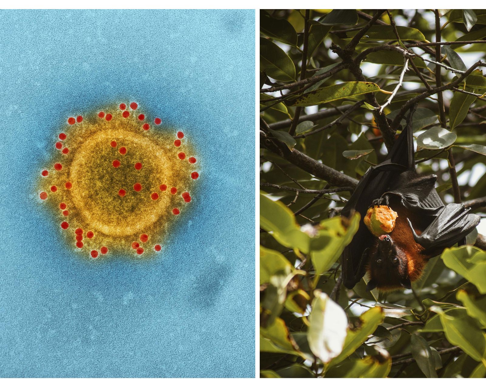 Here's what we know so far about the Nipah Virus